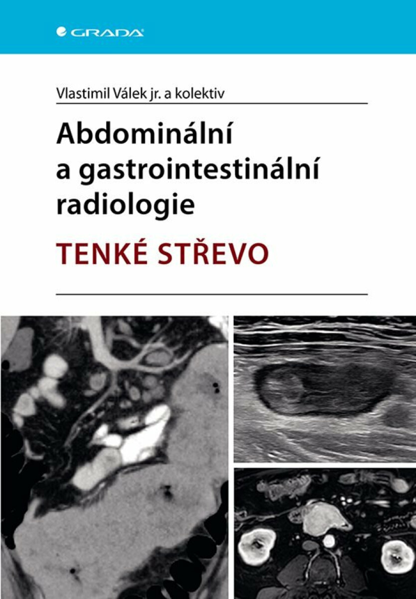 Abdominální a gastrointestinální radiologie - Tenké střevo