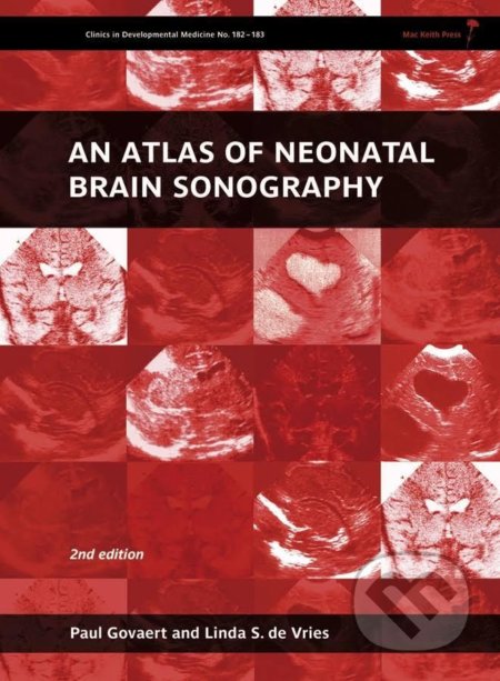 An Atlas of Neonatal Brain Sonography