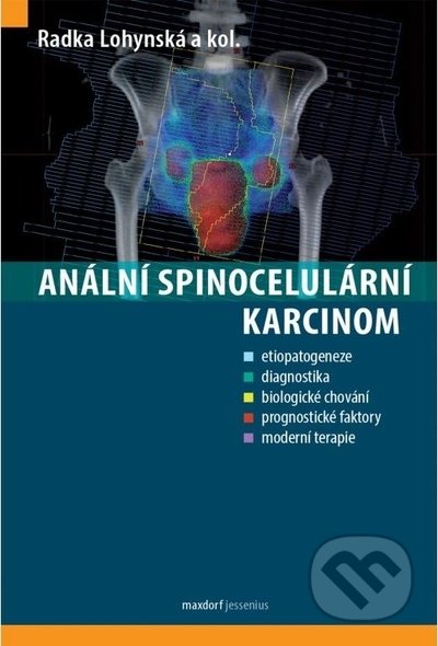 Anální spinocelulární karcinom
