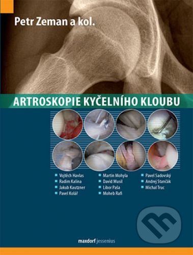 Artroskopie kyčelního kloubu