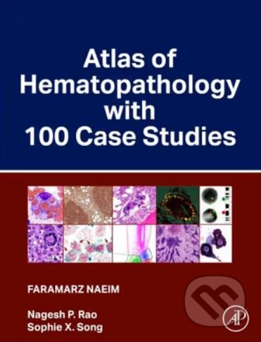 Atlas of Hematopathology with 100 Case Studies