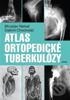 Atlas ortopedické tuberkulózy