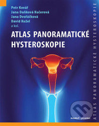 Atlas panoramatické hysteroskopie