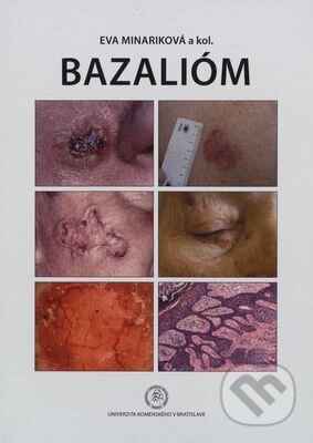 Bazalióm