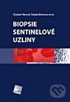 Biopsie sentinelové uzliny