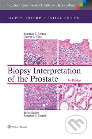 Biopsy Interpretation of the Liver