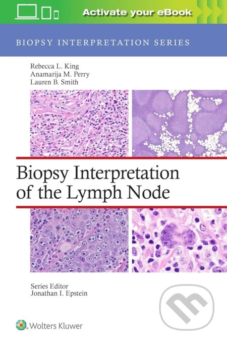 Biopsy Interpretation of the Lymph Node