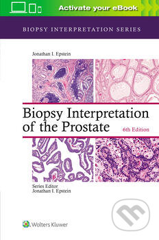Biopsy Interpretation of the Prostate