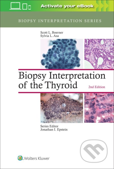 Biopsy Interpretation of the Thyroid