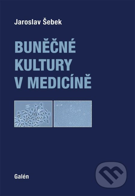 Buněčné kultury v medicíně