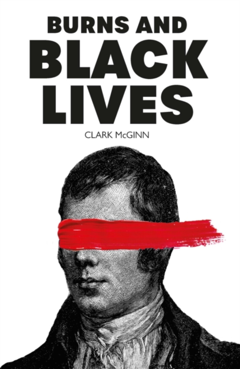 Burns and Black Lives