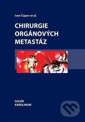 Chirurgie orgánových metastáz
