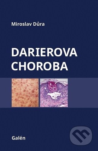 Darierova choroba