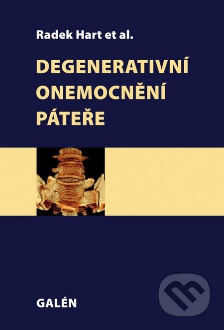 Degenerativní onemocnění páteře