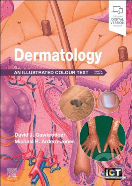 Dermatology (An Illustrated Colour Text)