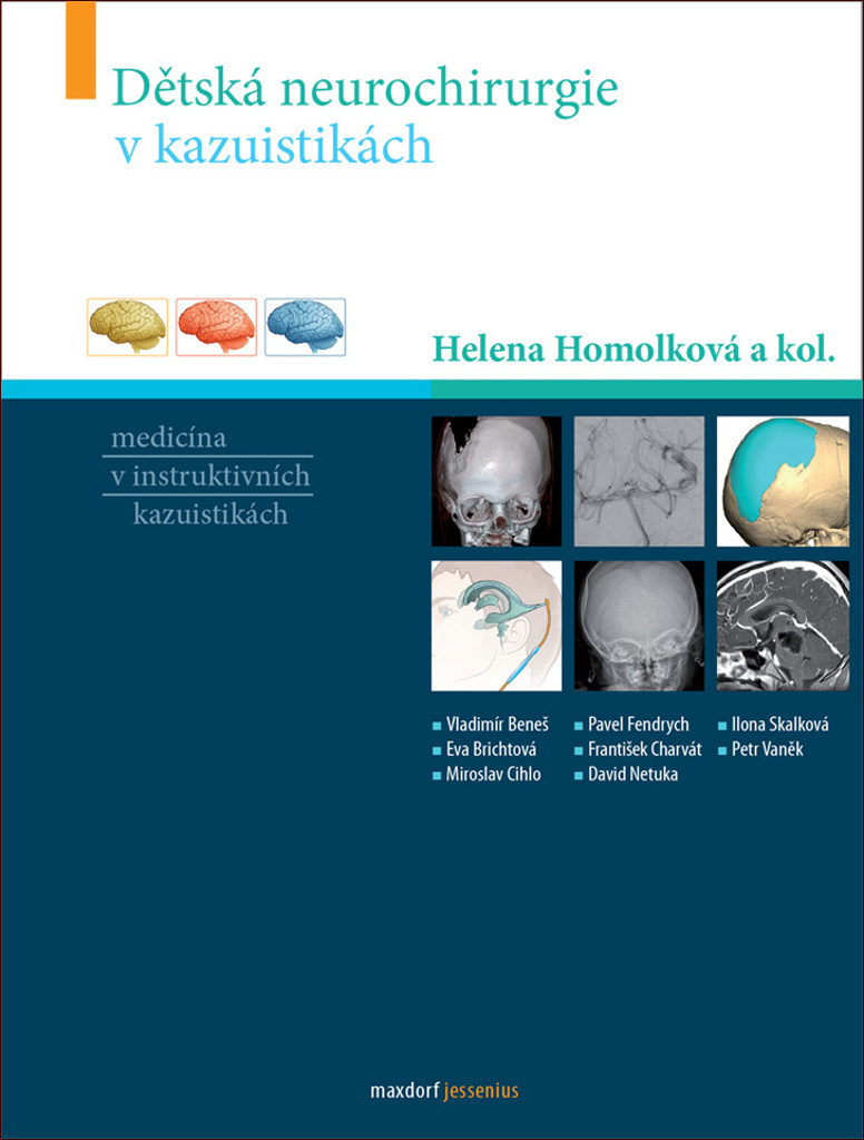 Dětská neurochirurgie v kazuistikách