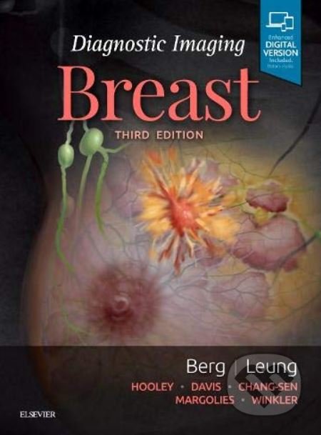 Diagnostic Imaging: Breast