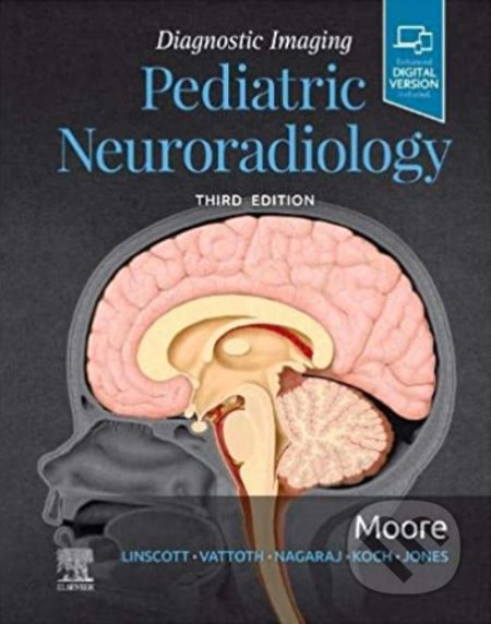 Diagnostic Imaging: Pediatric Neuroradiology