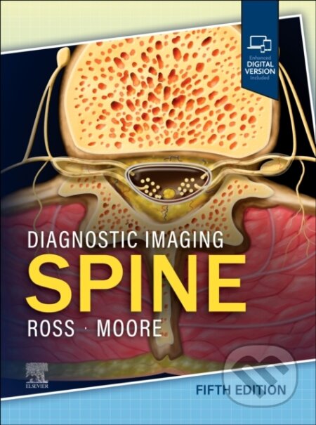 Diagnostic Imaging: Spine (Fifth Edition)