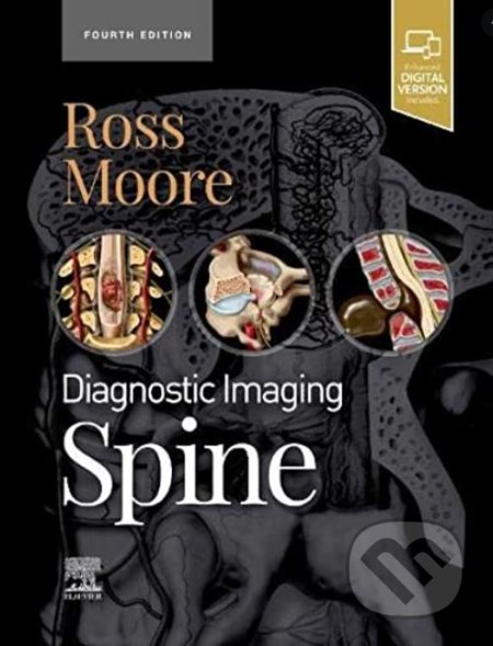 Diagnostic Imaging: Spine
