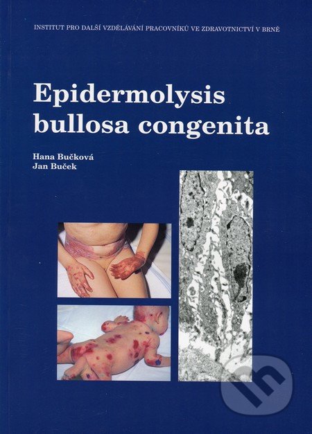 Epidermolysis bullosa congenita