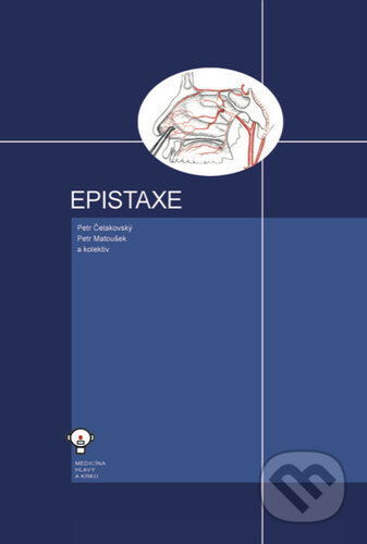Epistaxe