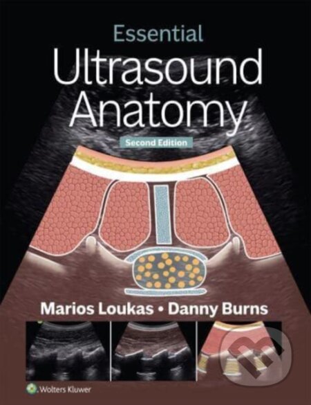 Essential Ultrasound Anatomy (Second Edition)