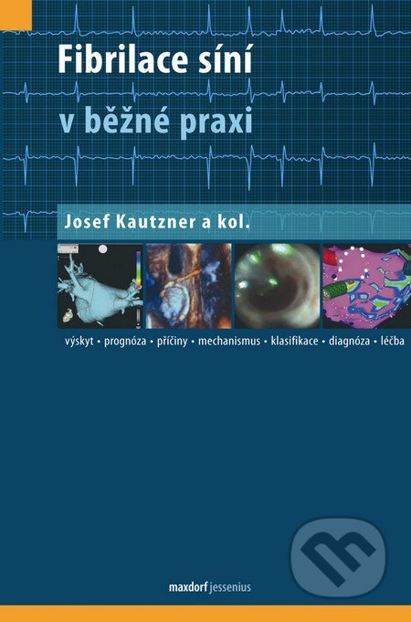 Fibrilace síní v běžné praxi