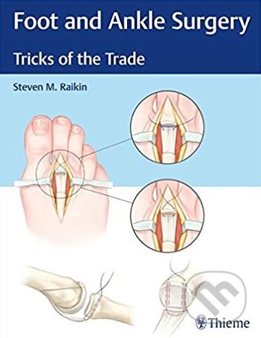 Foot and Ankle Surgery