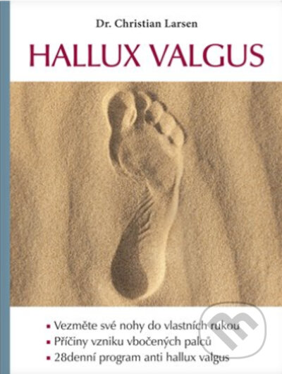 Hallux valgus
