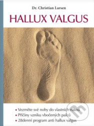 Hallux valgus