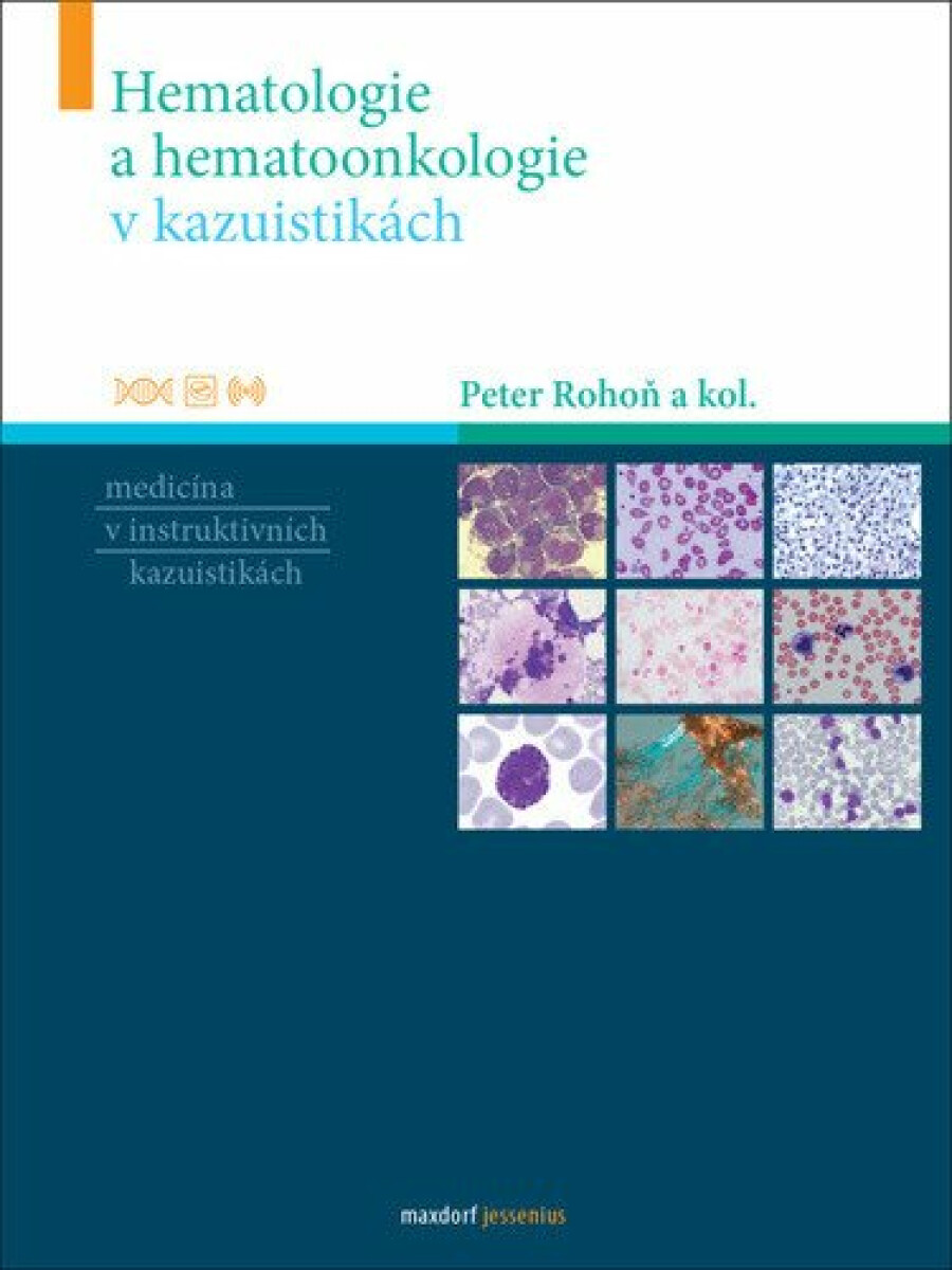 Hematologie a hemootonkologie v kazuistikách - Peter Rohoň