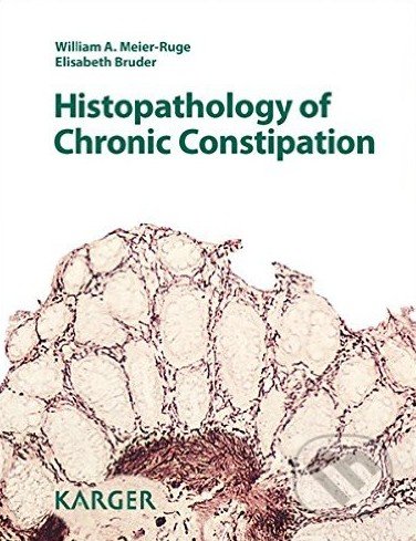 Histopathology of Chronic Constipation