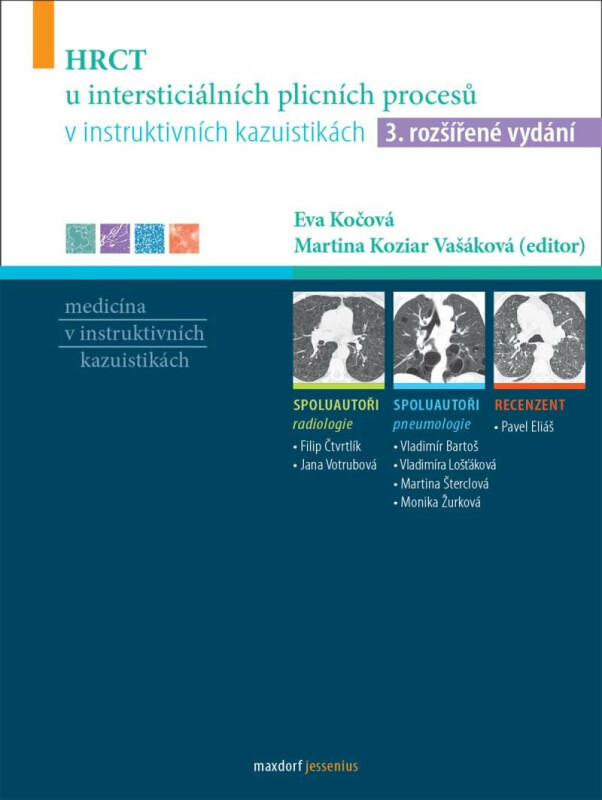 HRCT u intersticiálních plicních procesů v instruktivních kazuistikách - kolektiv autorů, Eva Kočová, Martina Koziar Vašáková