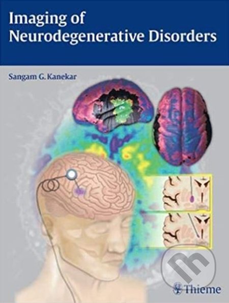 Imaging of Neurodegenerative Disorders