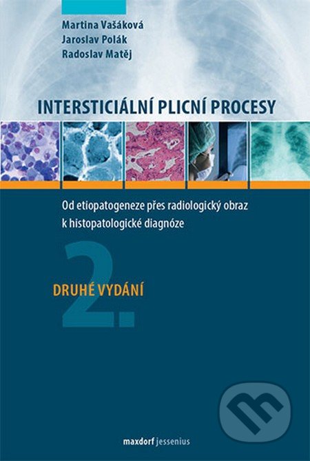 Intersticiální plicní procesy (2.vydání