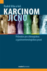 Karcinom jícnu (Průvodce pro chirurgickou a gastroenterologickou praxi) - kniha z kategorie Nefrologie a gastroenterologie