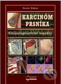 Karcinóm prsníka (Etiopatogenetické aspekty)