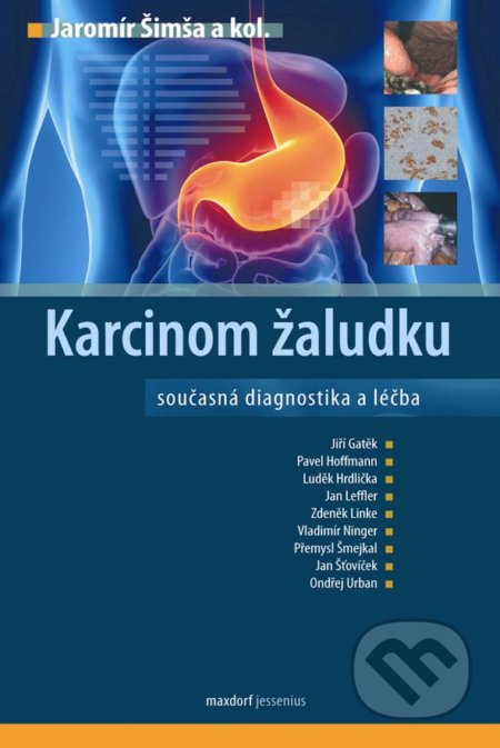 Karcinom žaludku (Současná diagnostika a léčba)