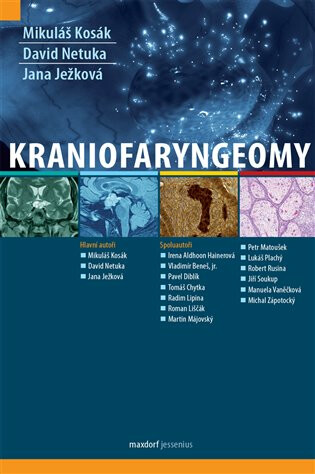 Kraniofaryngeomy - kolektiv autorů, David Netuka, Jana Ježková, Mikuláš Kosák