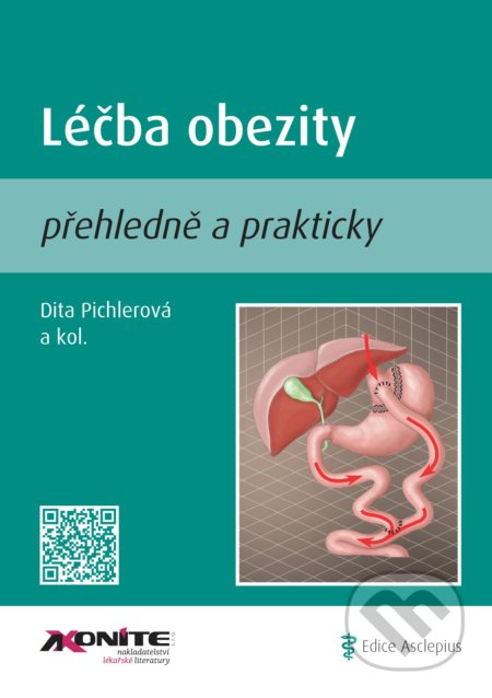 Léčba obezity (přehledně a prakticky)