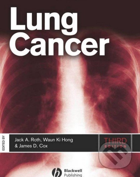 Lung Cancer