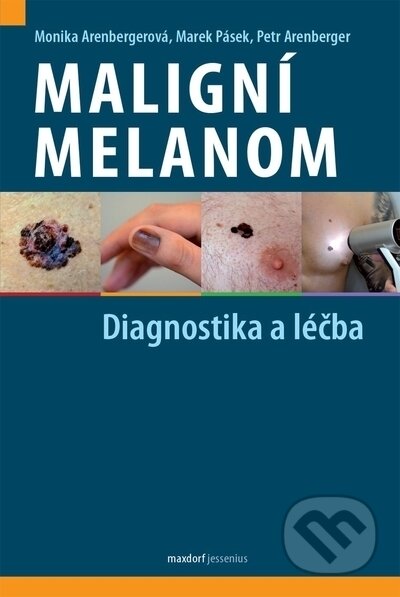 Maligní melanom (Diagnostika a léčba)