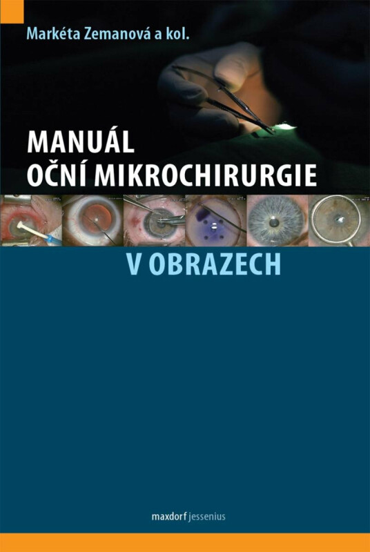 Manuál oční mikrochirurgie v obrazech - kolektiv autorů, Markéta Zemanová