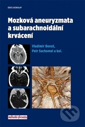 Mozková aneurysmata a subarachnoidální krvácení