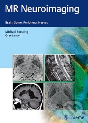 MR Neuroimaging (Brain, Spine, Peripheral Nerves)
