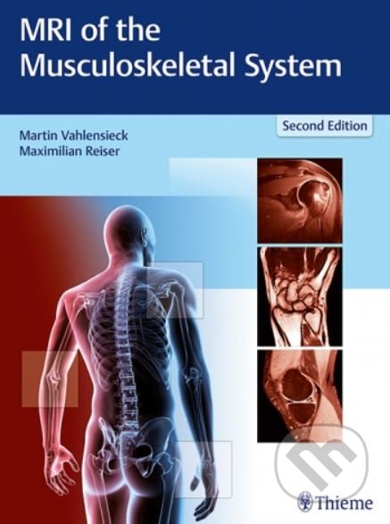 MRI of the Musculoskeletal System