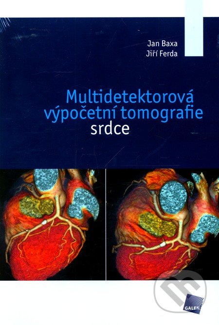 Multidetektorová výpočetní tomografie srdce