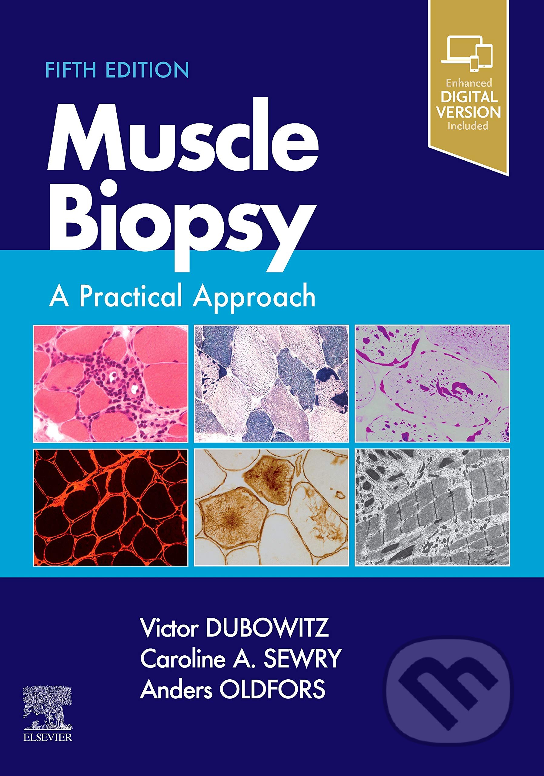 Muscle Biopsy (A Practical Approach)