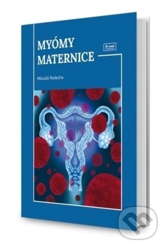 Myómy maternice
